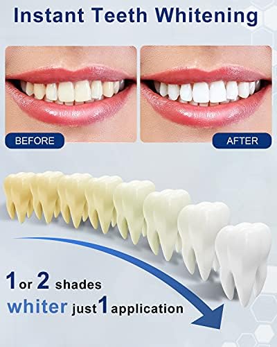 AZ חיוך עט הלבנת שיניים, 30+ טיפולים להלבנת שיניים ללא שיניים רגישות הלבנת ג'ל מלבן שיניים ידידותי לטיולים,