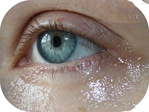 Bielita & Vitex mezocomplex קו עין Mezo Gel 30+ הידרציה עמוקה לכל סוגי העור, 30 מל עם חומצה היאלורונית,
